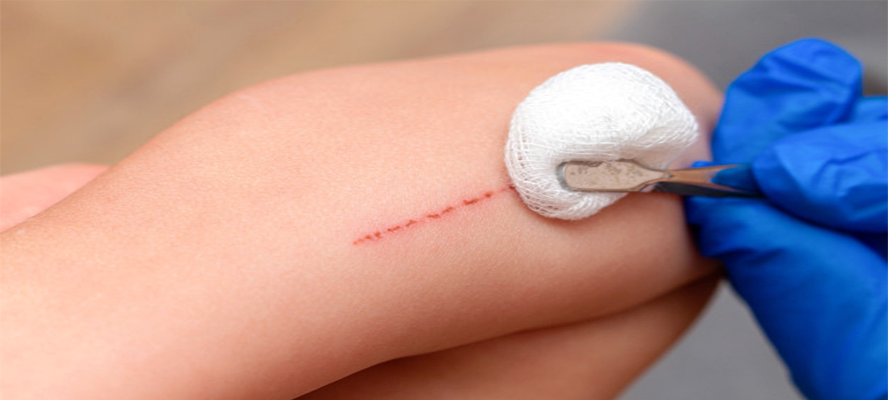 Makaleler - Ozon Sağlık Hizmetleri